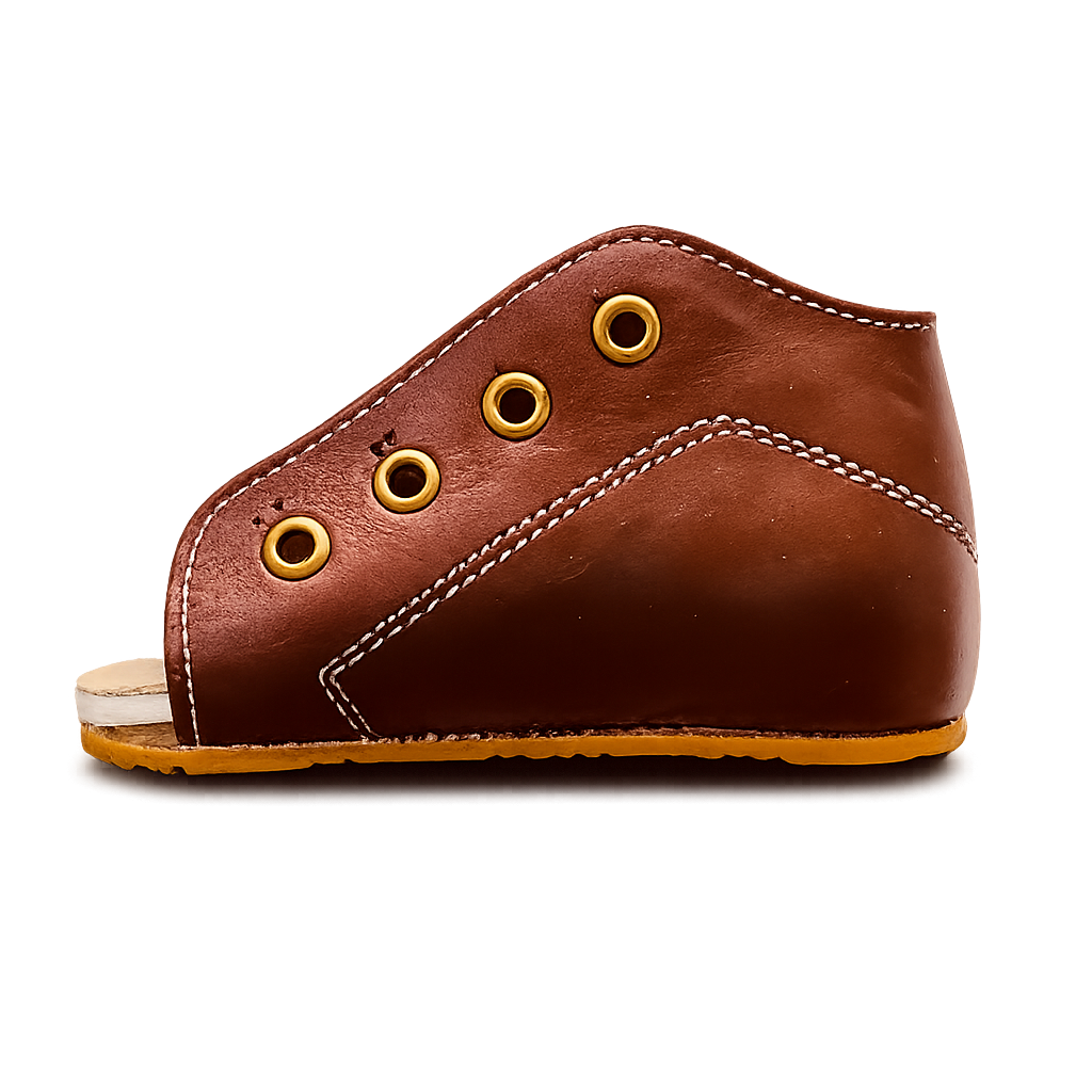 clubfoot